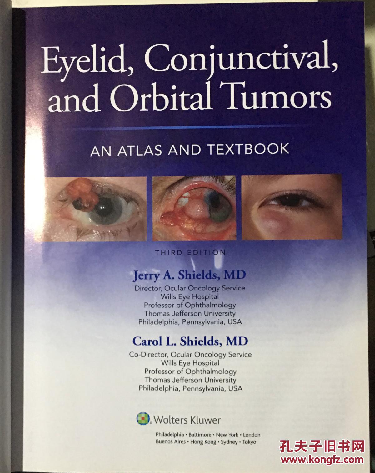 eyelid, conjunctival, and orbital tumors: an atlas and textbook
