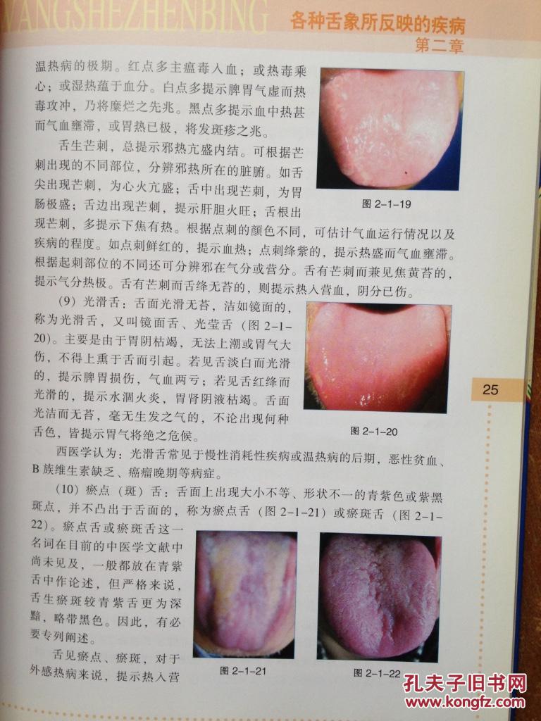 望舌诊病-赠光盘 b34