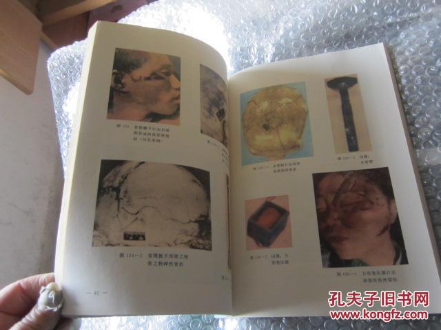 法医学机械性损伤图谱