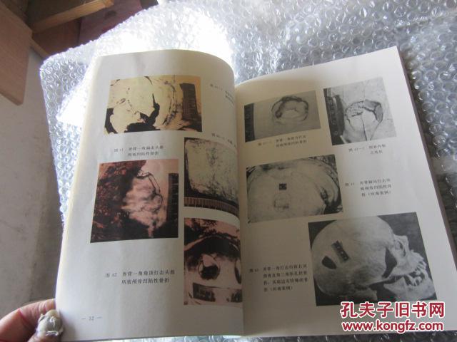 法医学机械性损伤图谱