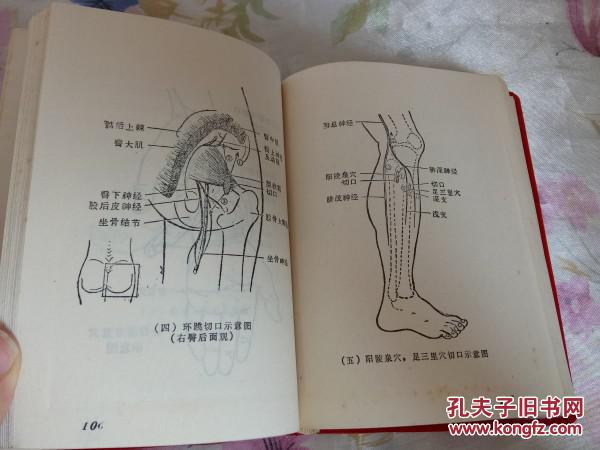 (内页介绍新针,穴位,埋线,经络,挑治,水针,耳针,拔罐,梅花针,捏脊