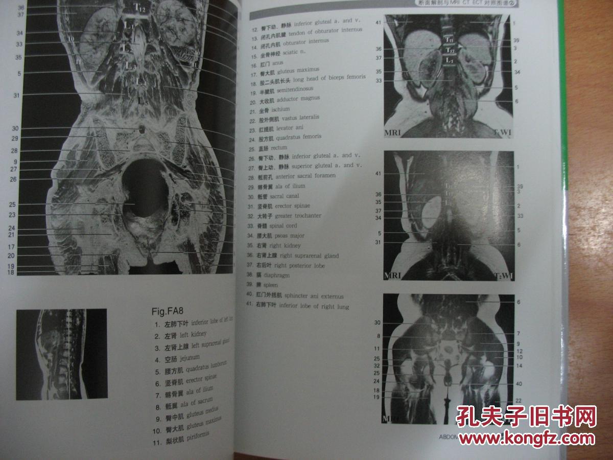 断面解剖与mri ct ect对照图谱2 腹部 盆部 四肢部(大
