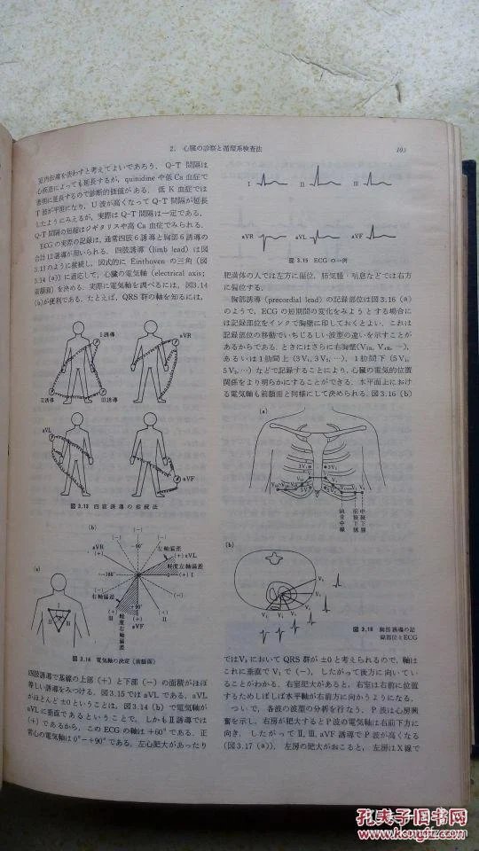 p4YBAFmNP9iANhCQAAE1iuqw61I468_b.jpg