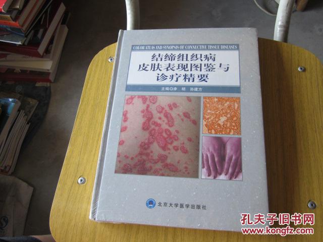结缔组织病皮肤表现图鉴与诊疗精要