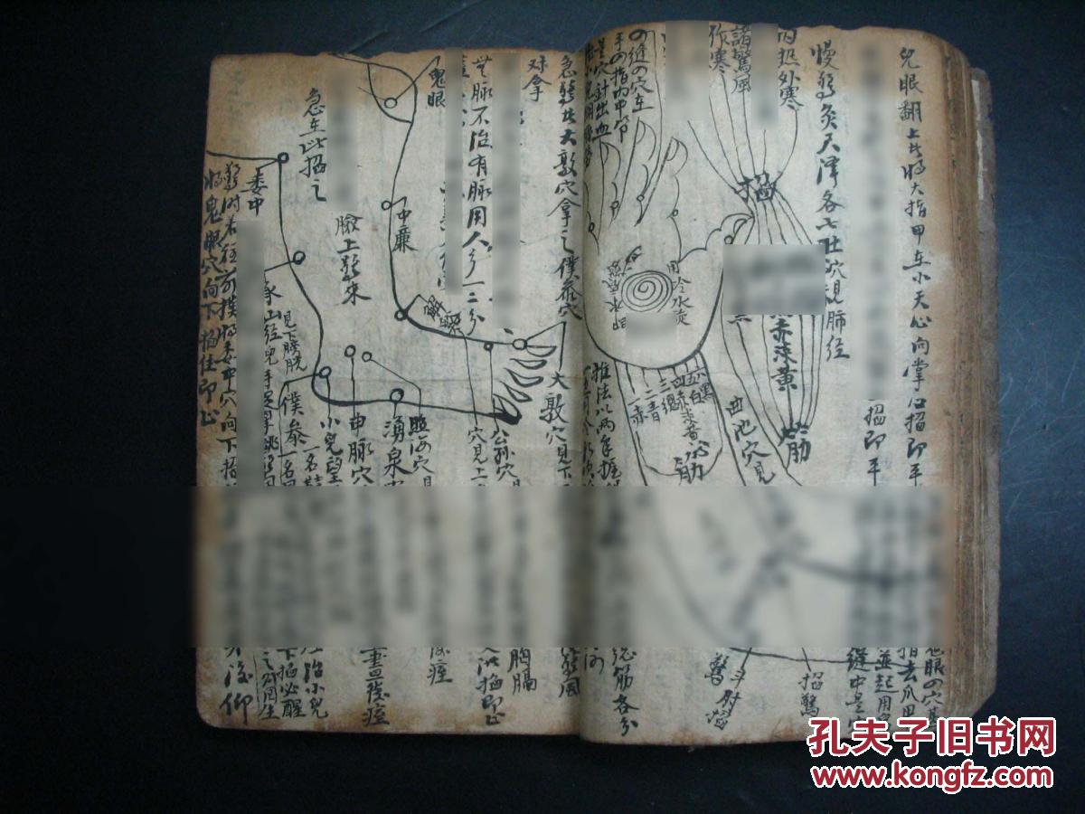 古本穴位按摩推拿手绘手抄【售高清打印复制件】病鬼