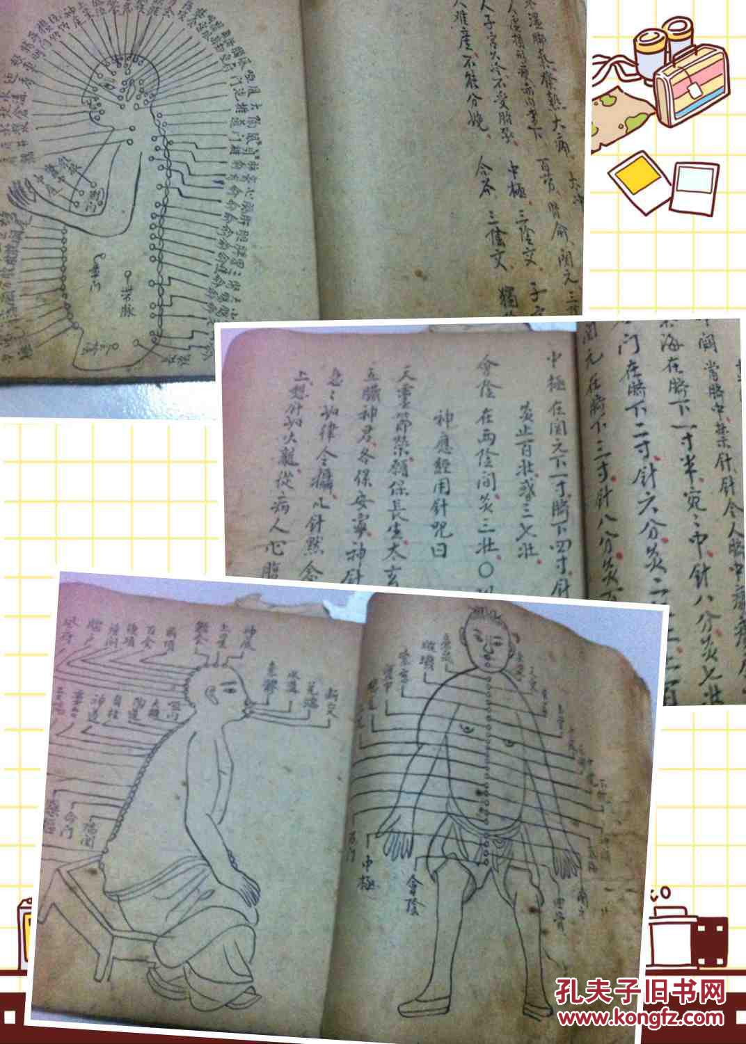 清代罕见手抄医书一超厚册全(有百穴法歌,玉龙歌,长桑君天星秘诀歌