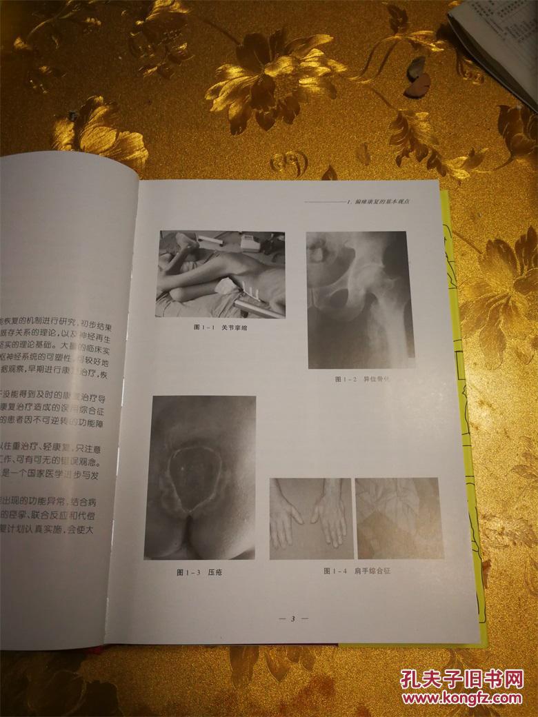 【图】偏瘫康复治疗技术图解第二版于兑生著华