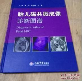 胎儿磁共振成像诊断图谱