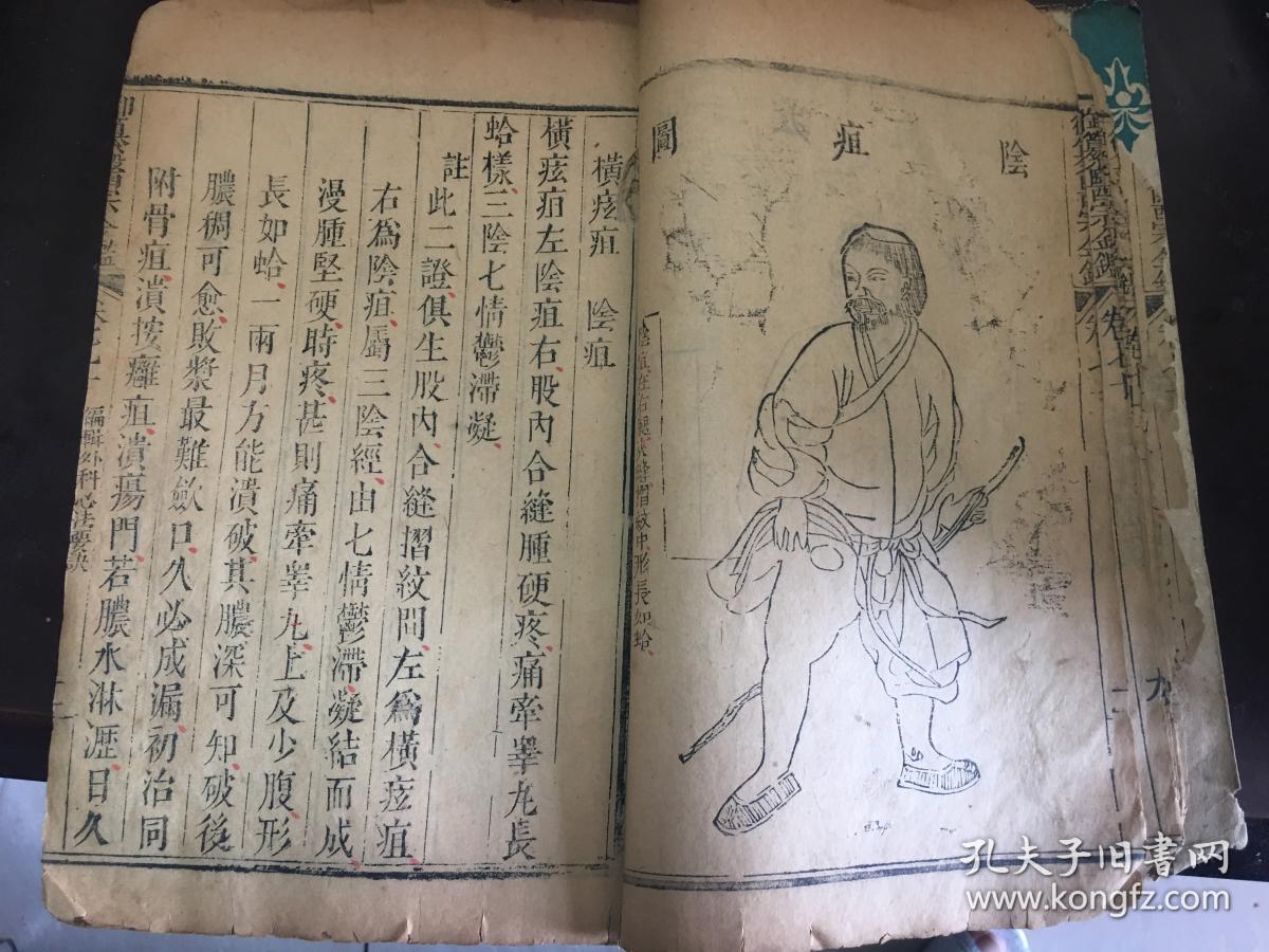 我处现有两册清朝木刻版老医书(一)针灸大成(25cmx15.