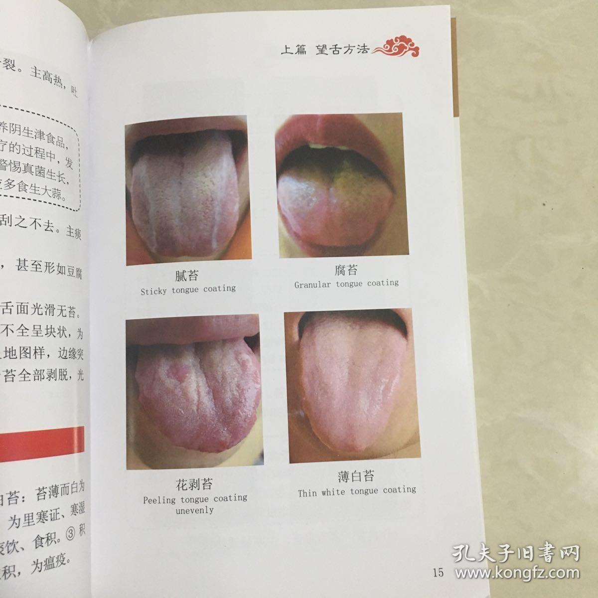 中医舌诊完全图解