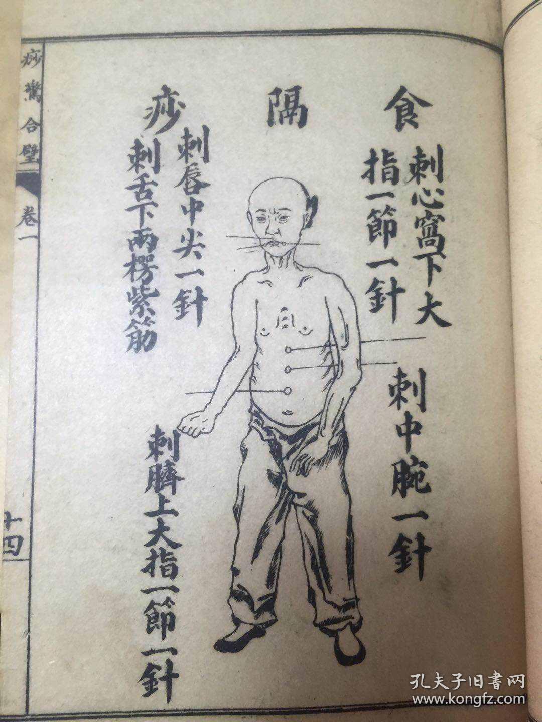 增图痧惊合璧 全四册四卷【民国六年出版】大量版图
