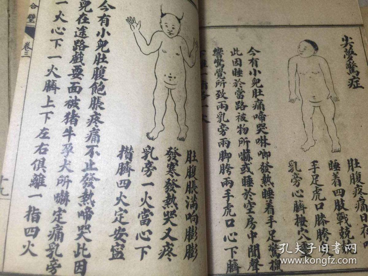 增图痧惊合璧 全四册四卷【民国六年出版】大量版图