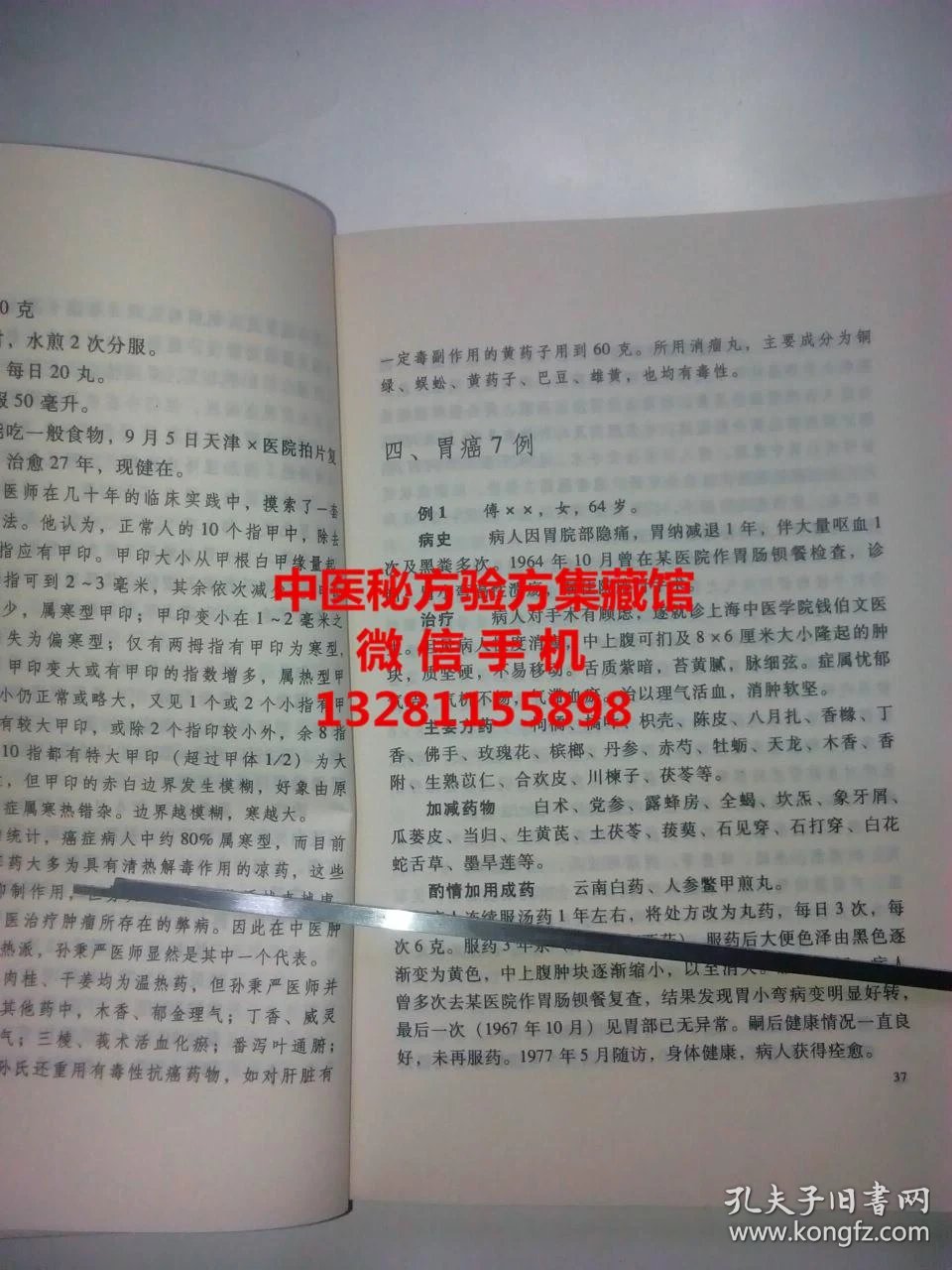 中医治疗肿瘤效果好的中成药 p4YBAFn2nK6AVw8SAAIsOfTbioc438_b.jpg