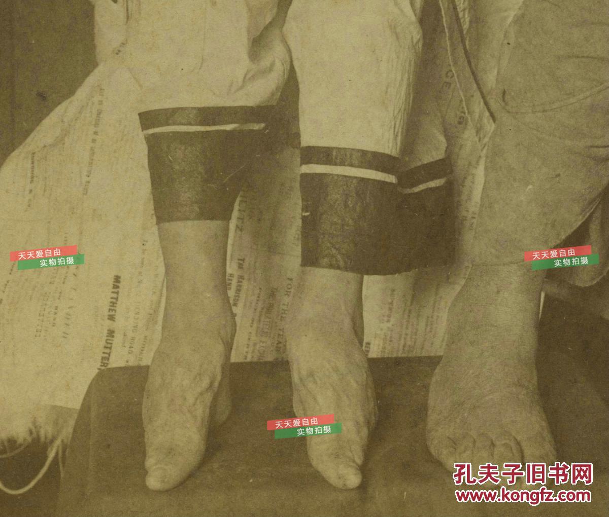 清末民国时期立体照片-清代三寸金莲的小脚,缠足风俗 和正常的脚