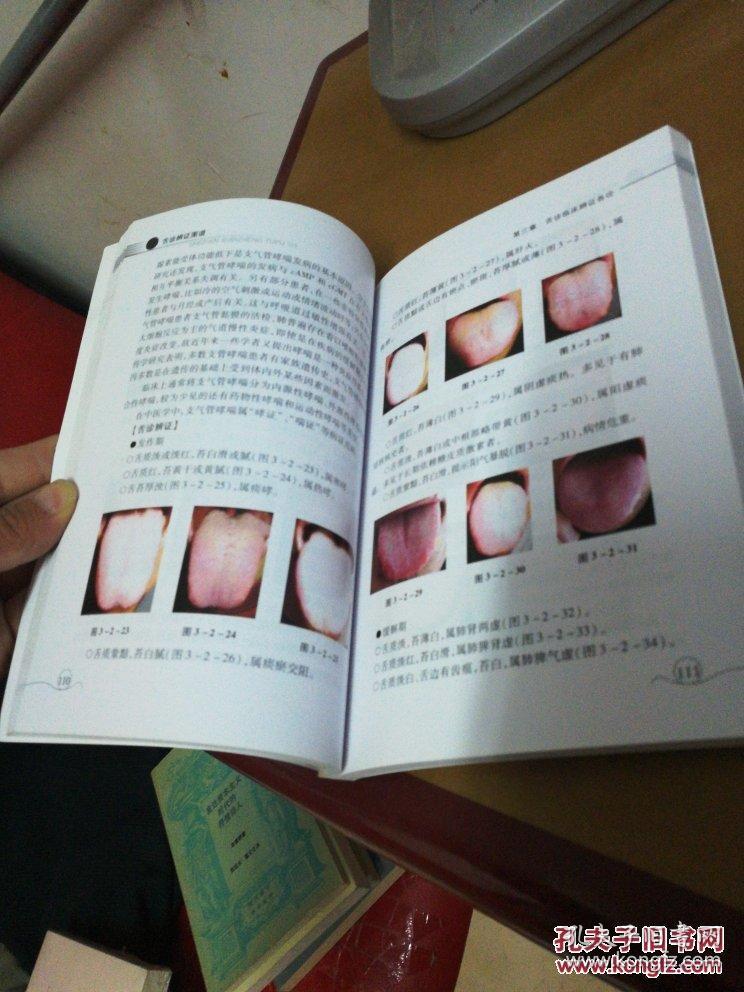 中医经验书】舌诊辨证图谱
