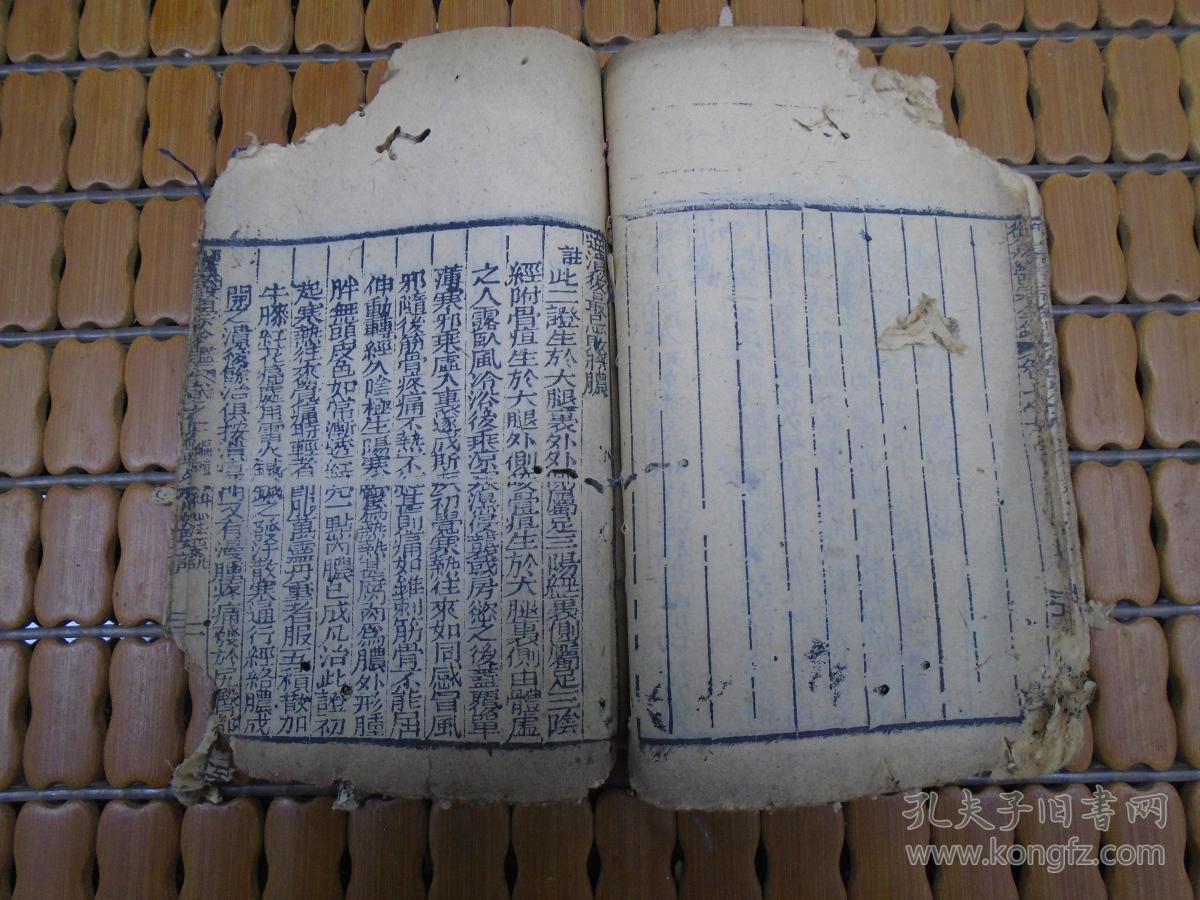 《御纂医宗金监》卷九卷十(编辑外科心法要诀:疳疮,妇人阴疮,鹳口疽