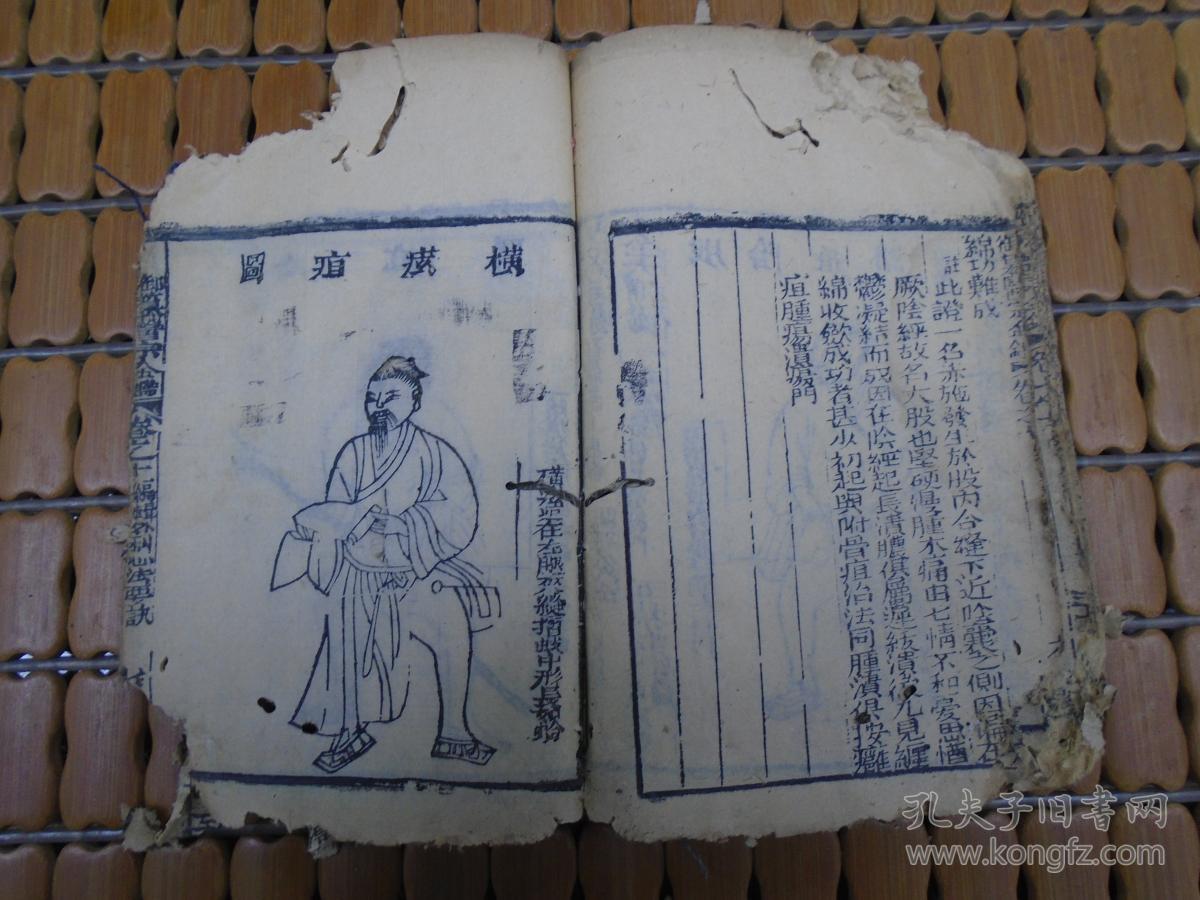 外科心法要诀:疳疮,妇人阴疮,鹳口疽,坐马痈,脏毒,痔疮,坐板疮,股阴疽
