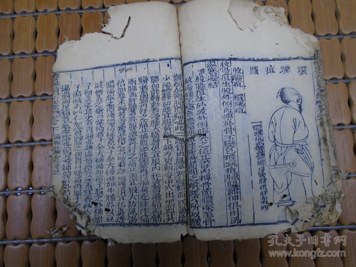 外科心法要诀:疳疮,妇人阴疮,鹳口疽,坐马痈,脏毒,痔疮,坐板疮,股阴疽