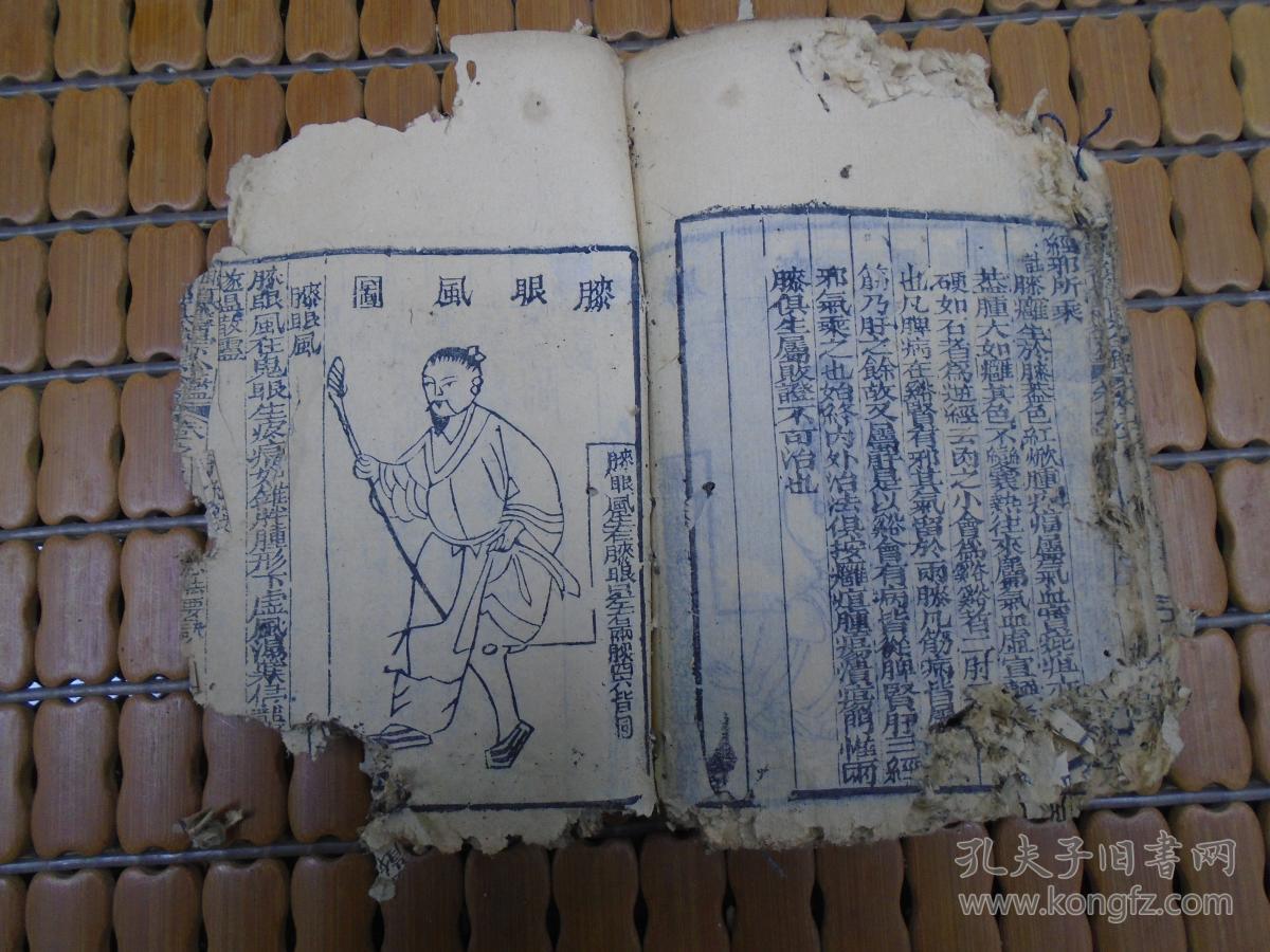 《御纂医宗金监》卷九卷十(编辑外科心法要诀:疳疮,妇人阴疮,鹳口疽