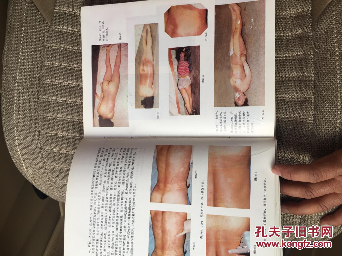 硬壳精装法医学图谱