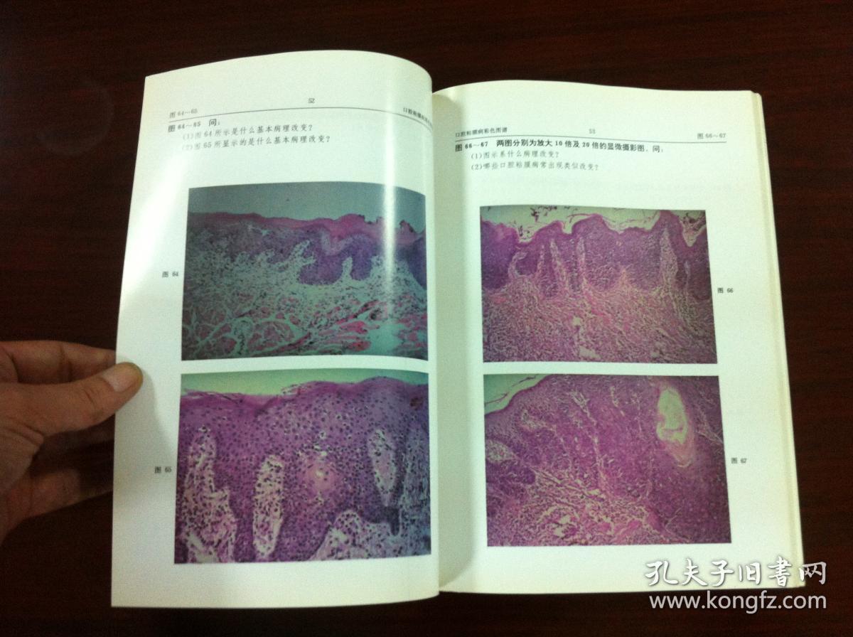 张文清主编《口腔粘膜病彩色图谱》(全1册),北京医科大学 中国协和