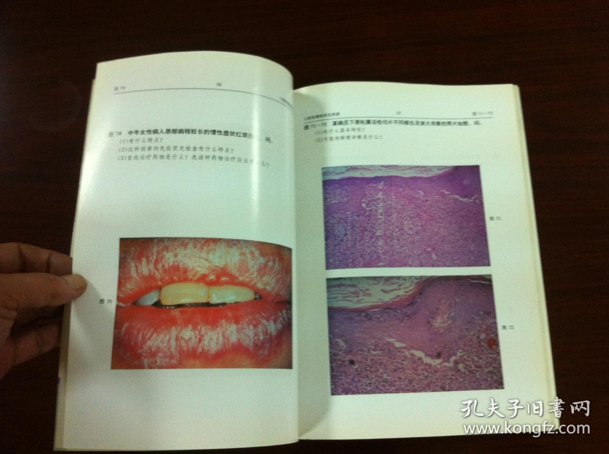 张文清主编口腔粘膜病彩色图谱全1册北京医科大学中国协和医科大学