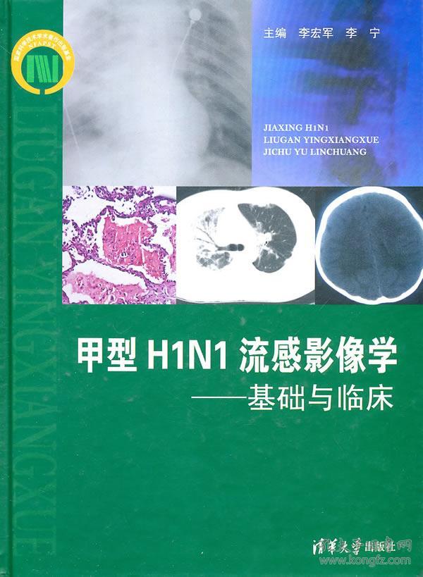 甲型H1N1流感影像学:基础与临床