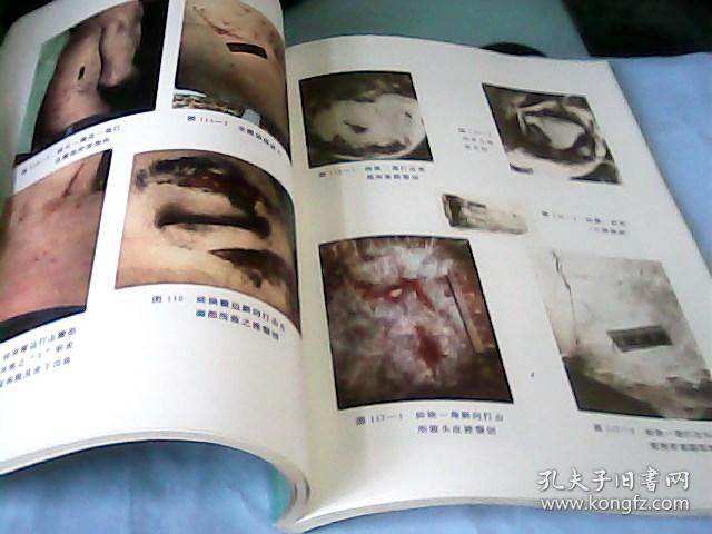 法医学机械性损伤图谱---存放南架二(1)