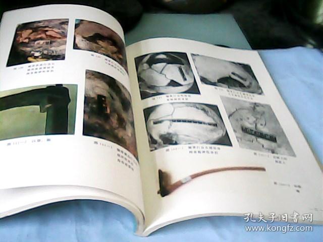 法医学机械性损伤图谱-存放南架二(1)