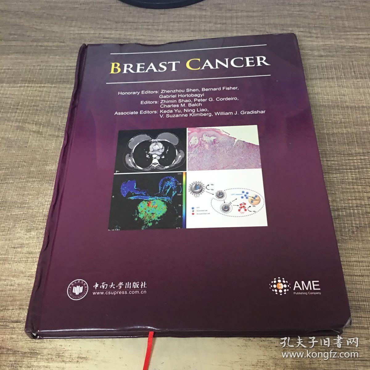 乳腺癌(英文版)