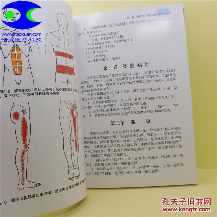 人体经筋病治疗与扳机点图解