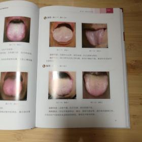 中医舌诊临床图解