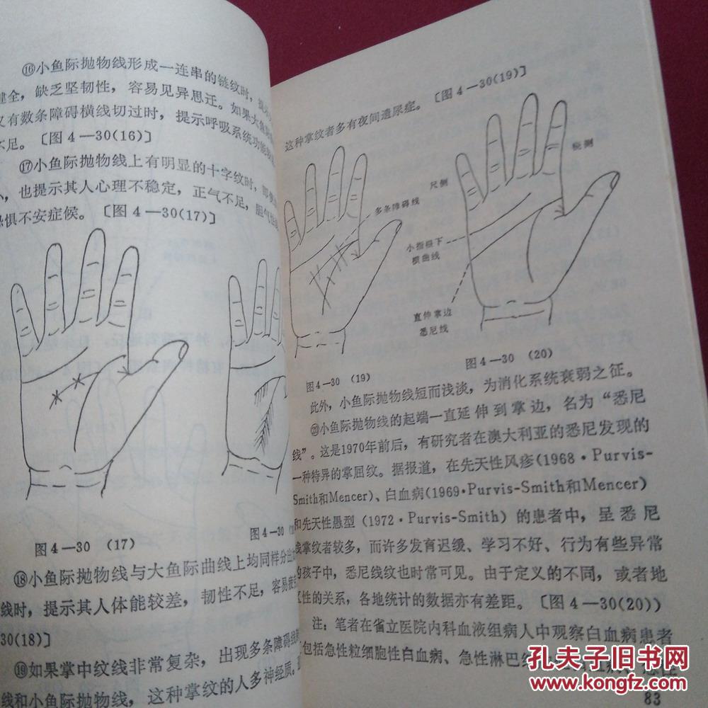 手纹与健康