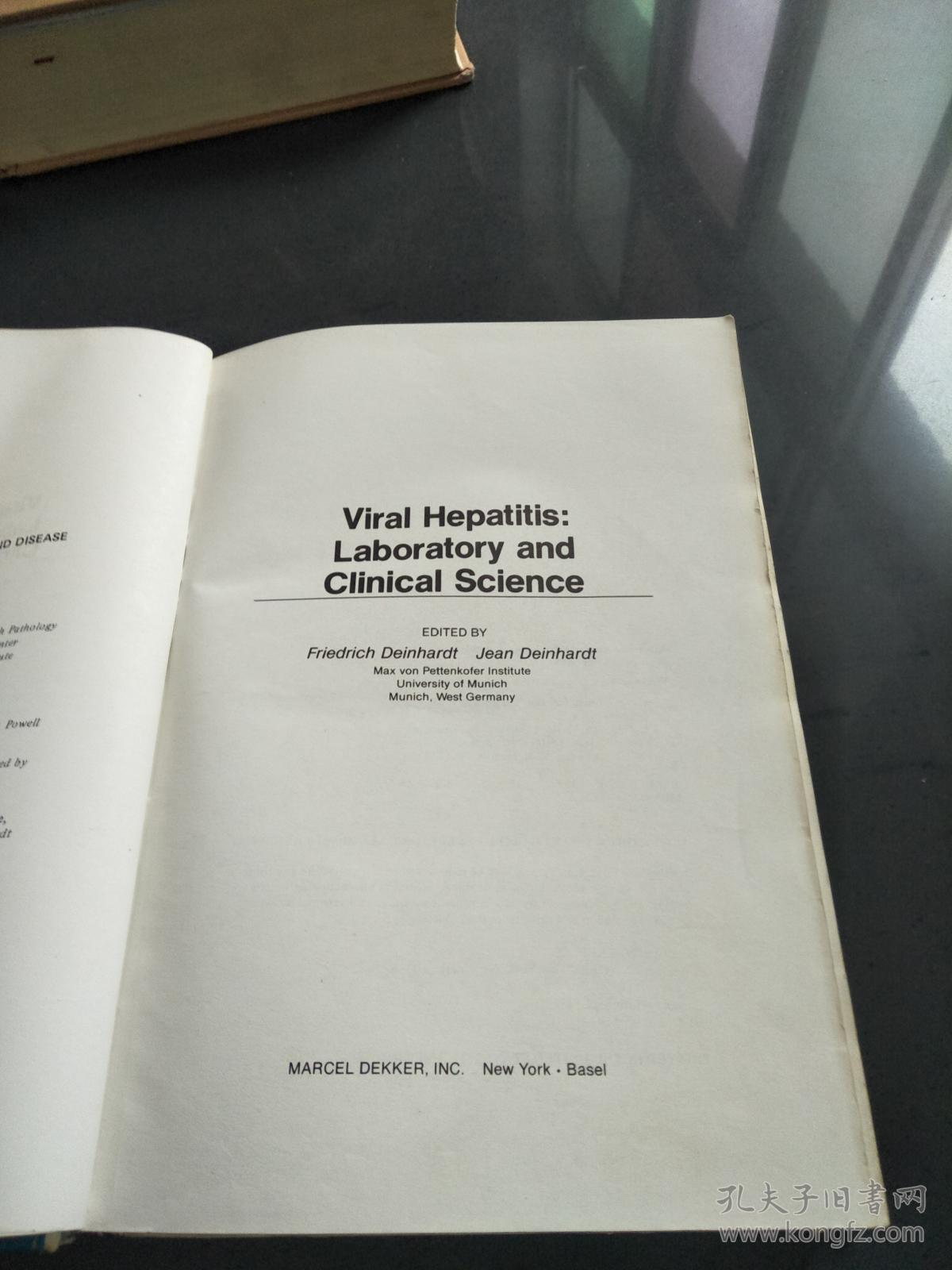viral hepatitis
