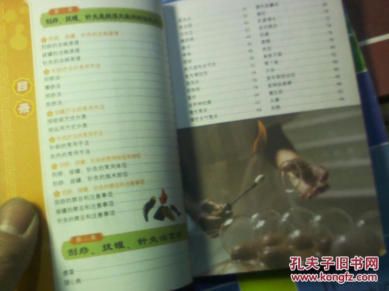 招聘针灸_天禄堂国医馆招聘针灸推拿学徒(4)
