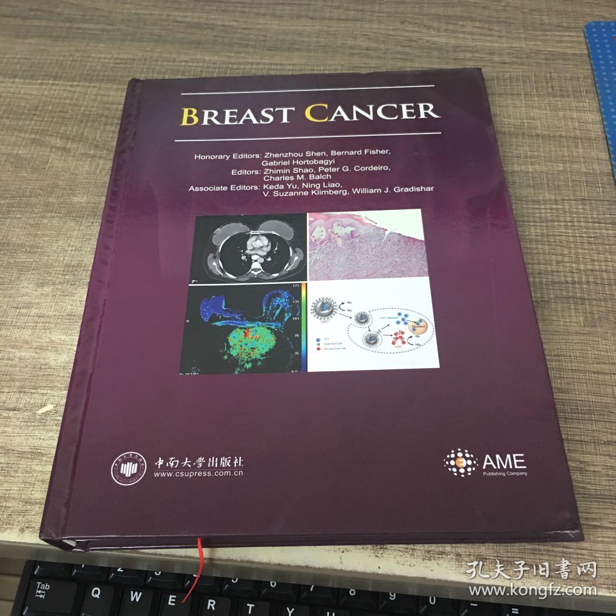 乳腺癌(英文版)