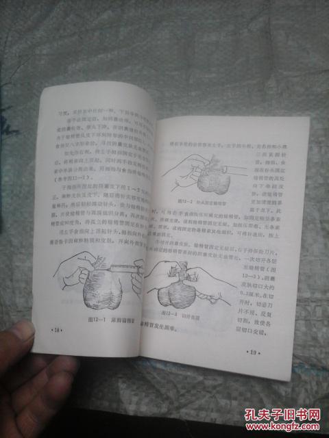 【图】男性节育手术及并发症的防治(增订本)_