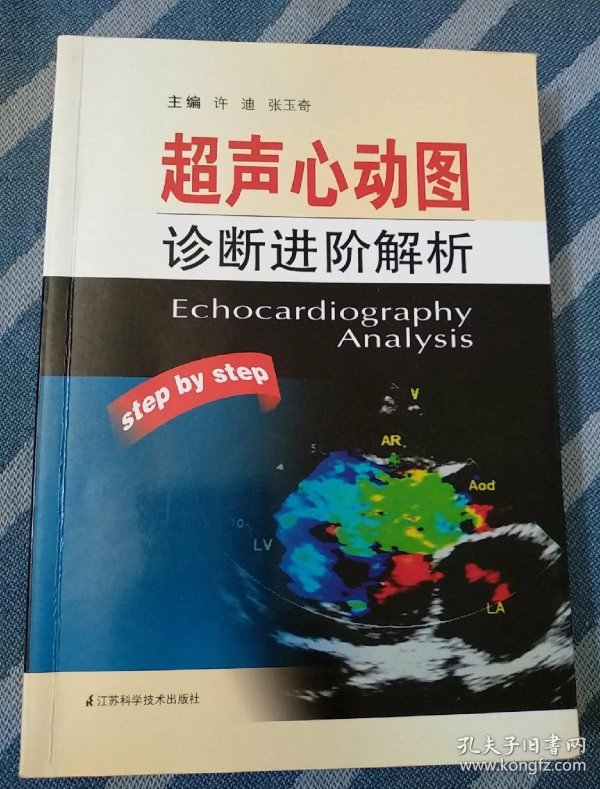 超声心动图诊断进阶解析馆藏
