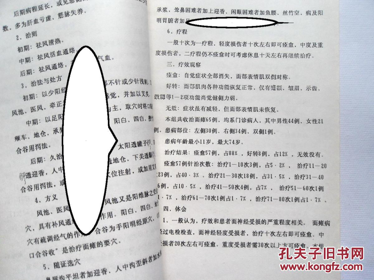 【图】油印:《针灸治疗面部神经麻痹》._油印