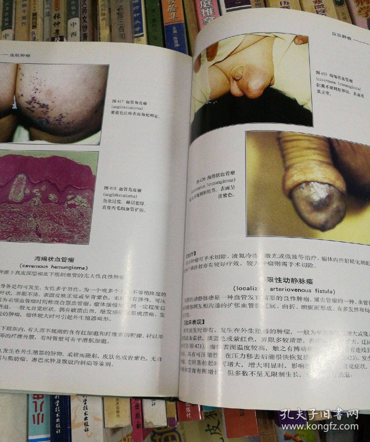 外生殖器皮肤病性病彩色图谱