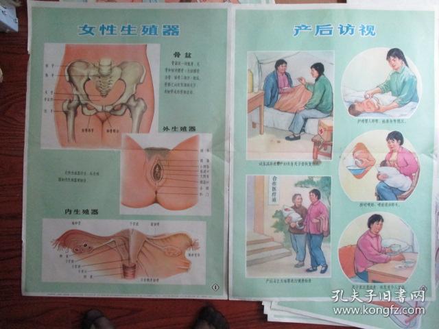 早期宣传画:新法接生挂图(供赤脚生用)【女性生殖器】