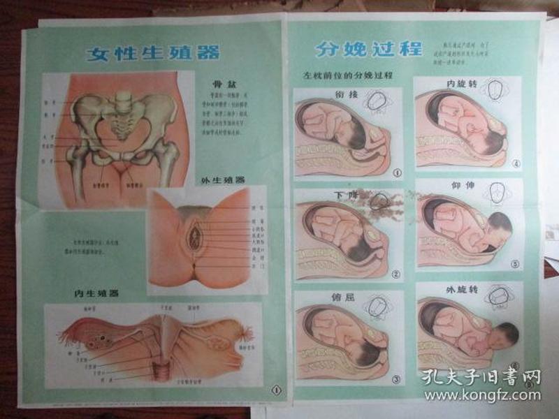 早期宣传画:新法接生挂图(供赤脚生用)【女性生殖器】【分娩过程】2张