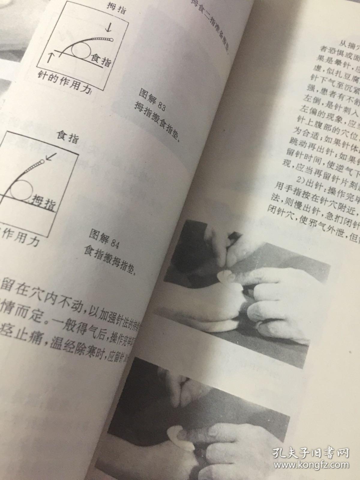 针灸补泻手法——1995年1版1印,16开精装,中医类(郑魁山 编著)