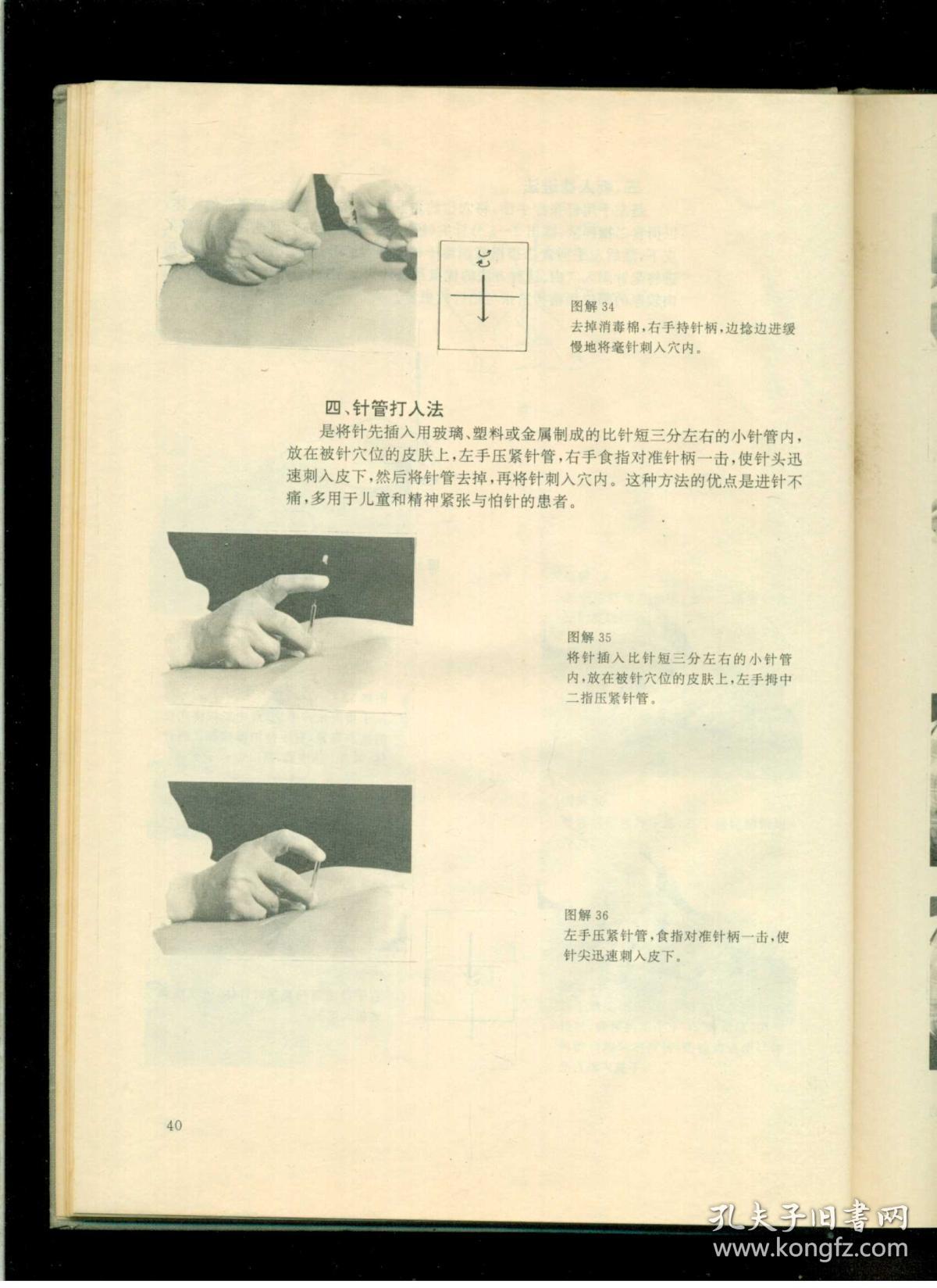 《针灸补泻手法》(甘肃名医郑魁山编著)(16开硬精装 黑白图文本 仅印