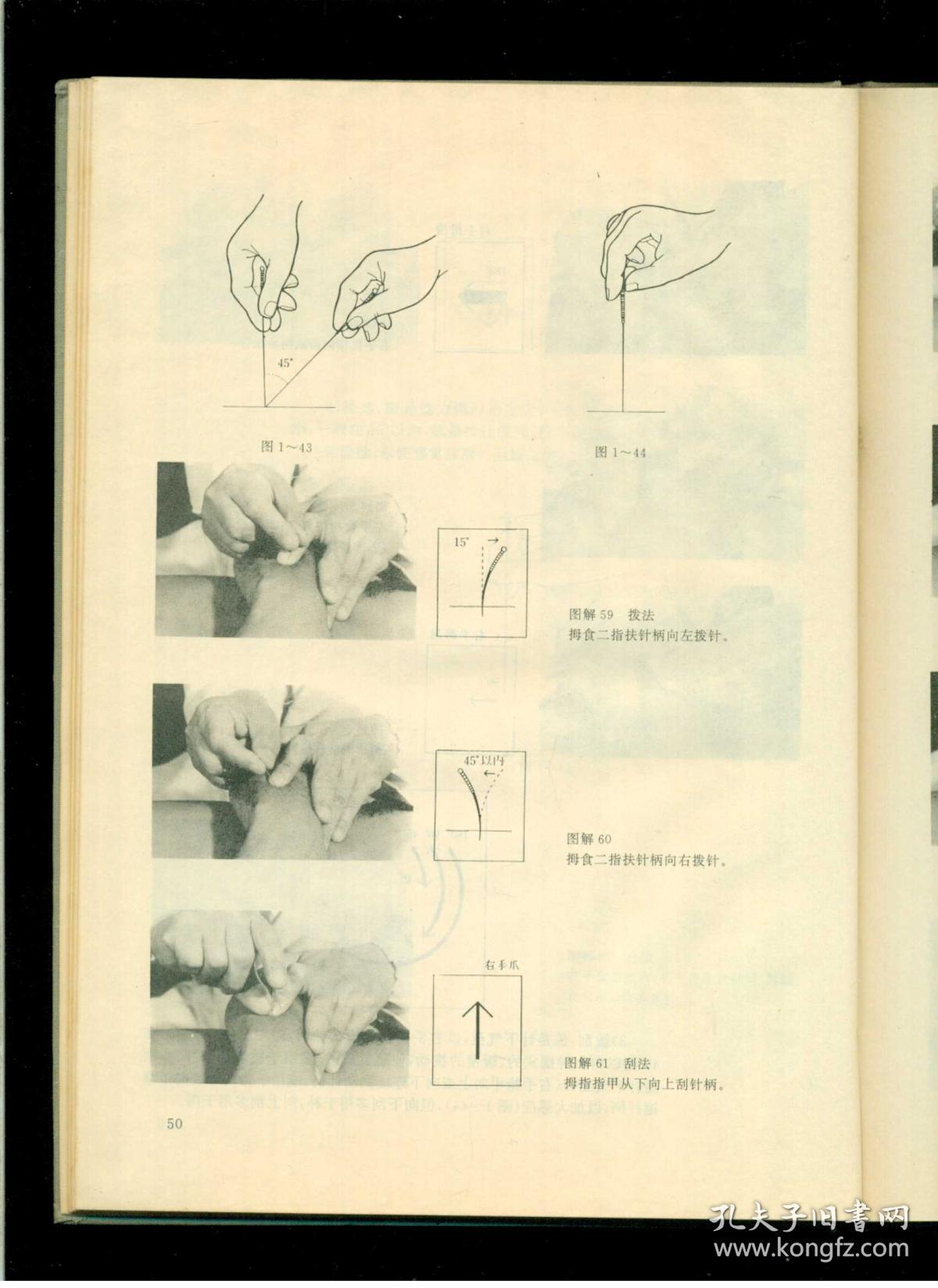 《针灸补泻手法》(甘肃名医郑魁山编著)(16开硬精装 黑白图文本 仅印