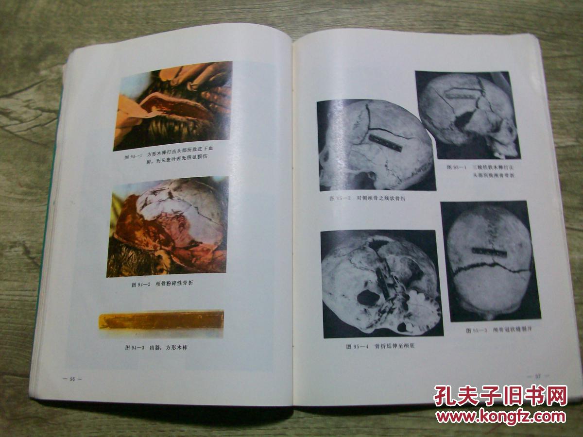 法医学机械性损伤图谱(内页有损)b28-2