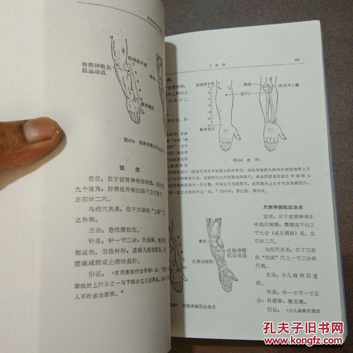 针灸简谱_中医针灸图片