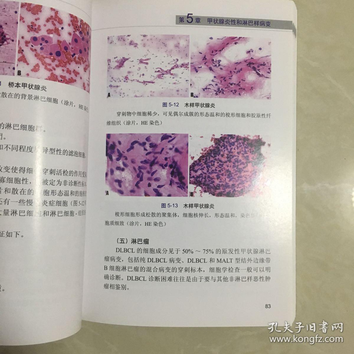 甲状腺细胞病理图谱