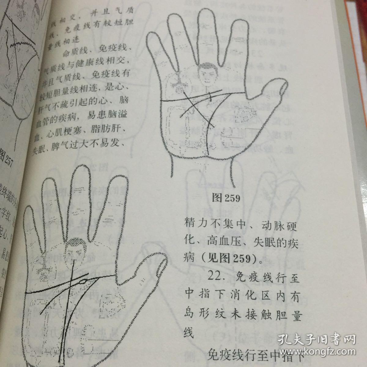 手诊图典:微经络平衡整体自然诊疗法