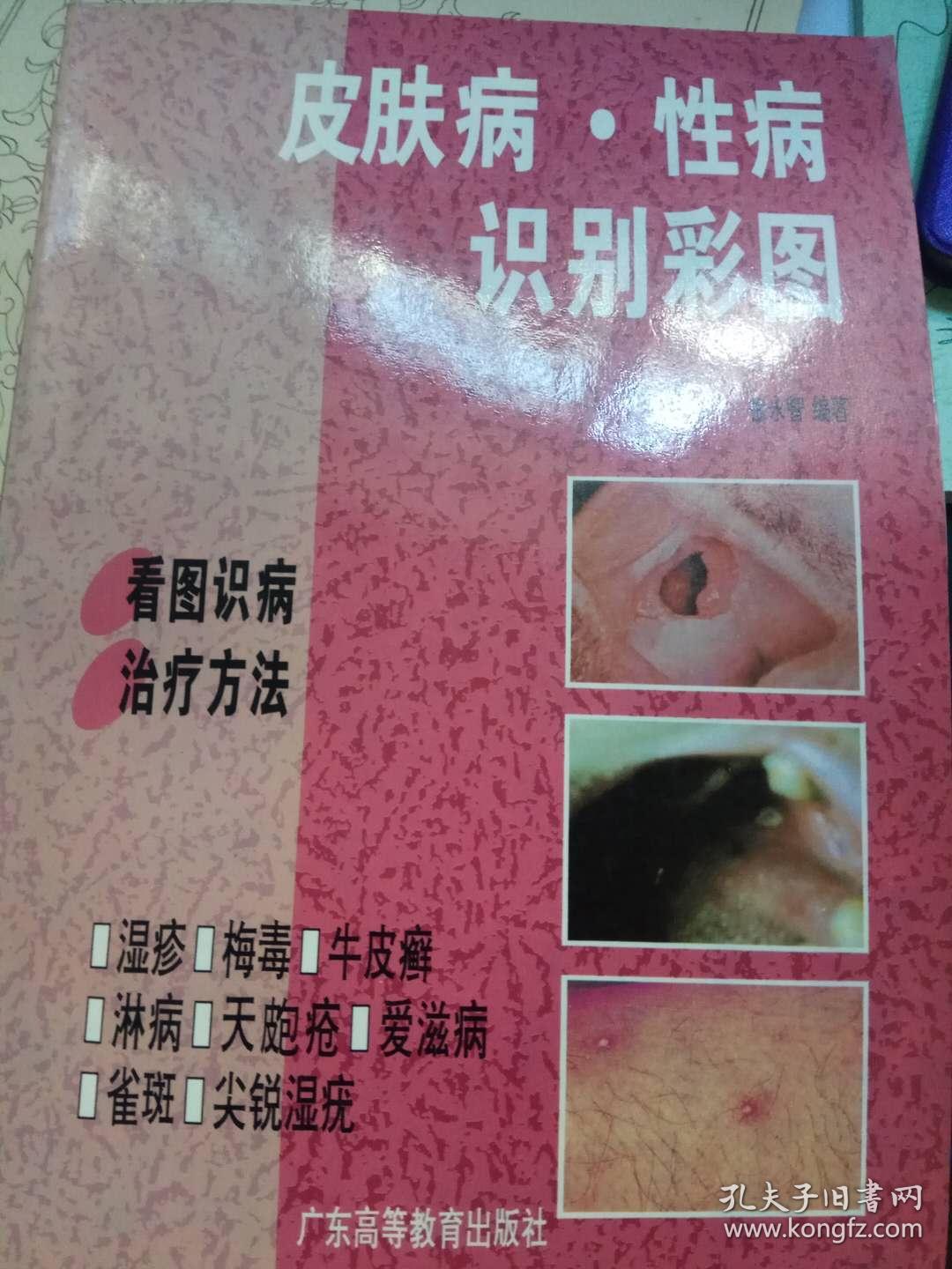 皮肤病·性病识别彩图